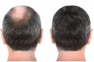 CelluHair reviews