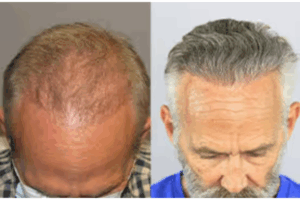 CelluHair reviews