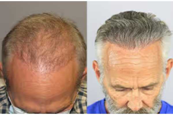 CelluHair reviews