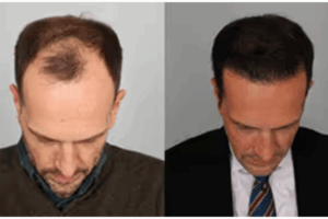 CelluHair reviews